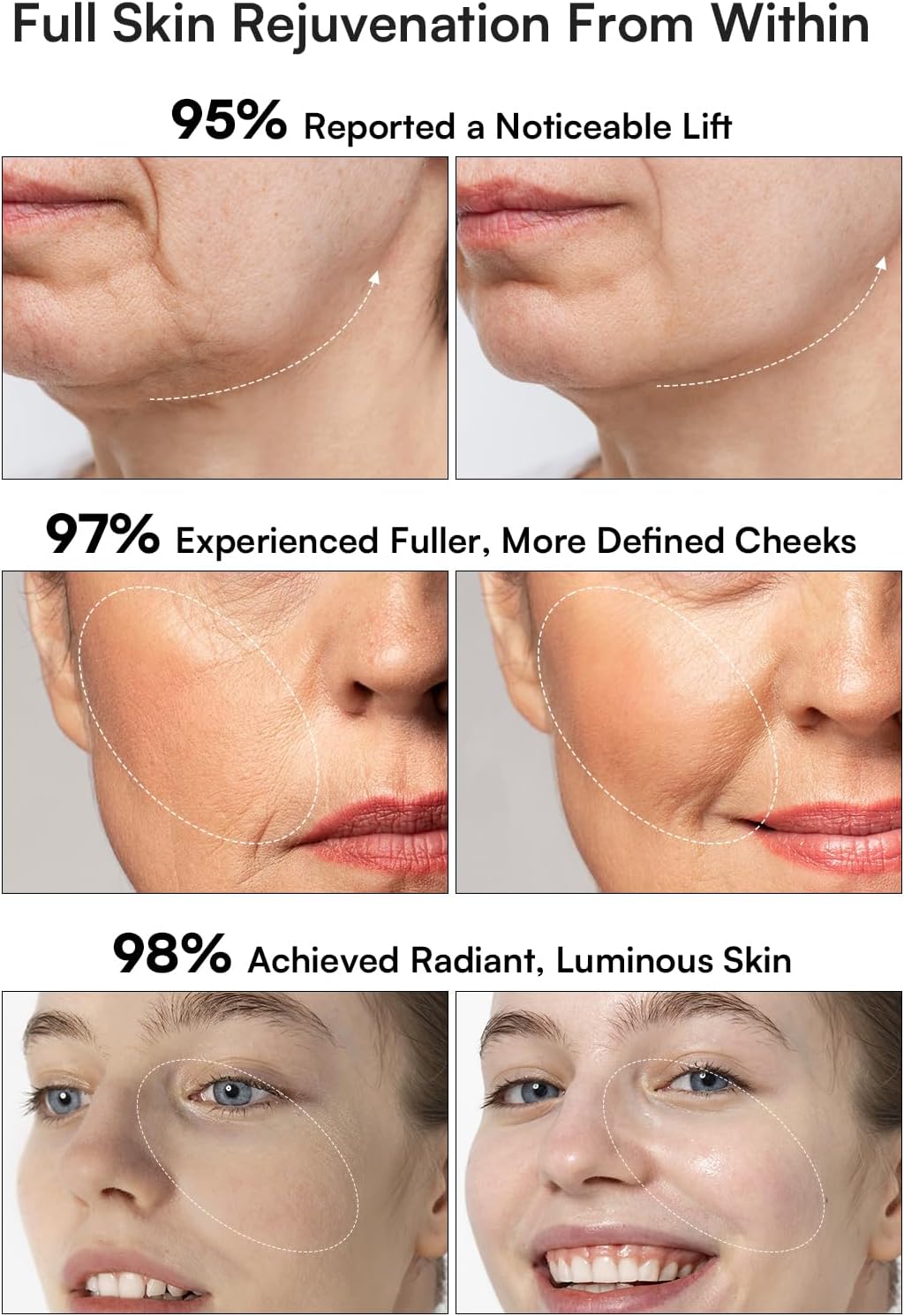 Red Light Therapy Face & Neck Massager - 3-in-1 Anti-Aging Skincare Device for Lifting, Firming & Rejuvenation